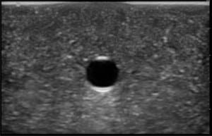 Figure 3. Short-axis image of the Blue Phantom™ rubber matrix and simulated vessel prior to any needle punctures.