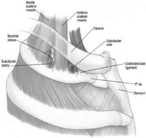 Figure 1. Normal anatomy of the thoracic outlet. Foot note: Reproduced with permission from Urschel et al, Ann Thorac Surg 2008;86:254–60 12 Copyright Elsevier Inc, 2008.