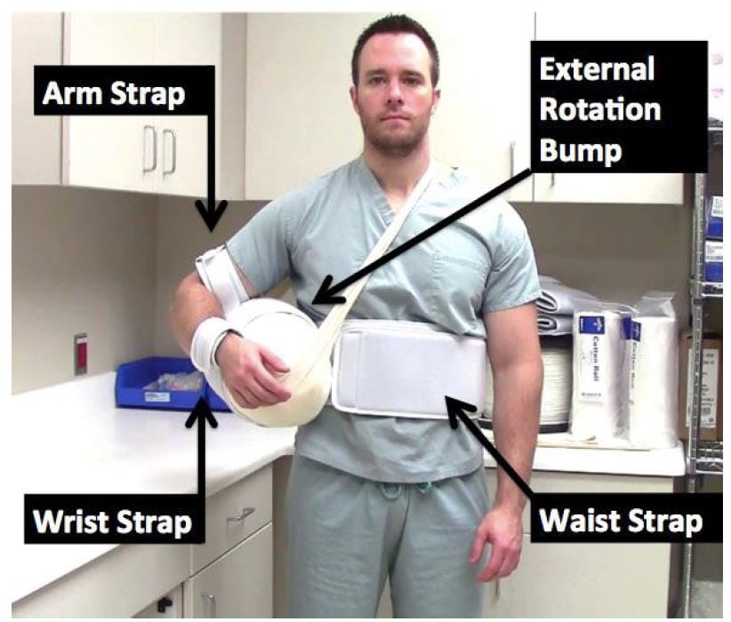 Low-Cost Alternative External Rotation Shoulder Brace and Review