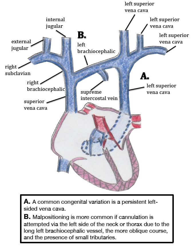 left subclavian vein anatomy