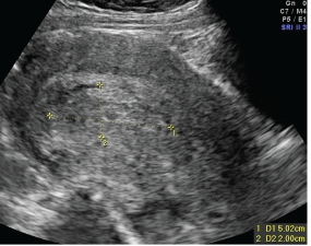 Cureus  A Systematic Review of Vertigo: Negligence in Pregnancy