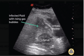 Cureus  A Systematic Review of Vertigo: Negligence in Pregnancy