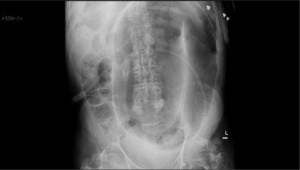 Figure 1. Abdominal radiograph