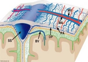 Figure 2b. Three dimensional view of the dural anatomy. The meningeal arteries (MA) and veins (MV) are superficially located, while the dural venous plexus (DP) is located within the inner portion of the dura (intradural). The dural plexus is particularly dense parasagittally, where it connects to the sagittal sinus independently of the cortical BV. From Mack, et. al. 2009. BV, bridging vein; MA, meningeal artery; MV, meningeal vein; PA, penetrating arteriole extending to inner dural plexus; DP dural plexus; SS, superior sagittal sinus. Reproduced with permission Mack et al, Pediatr Radiol. 2009; 39:200–1028 Copyright Springer, 2009.