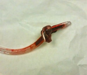 Figure 2. Photograph taken of the knotted tube immediately after removal.