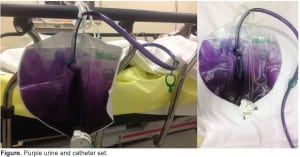 Figure. Purple urine and catheter set.