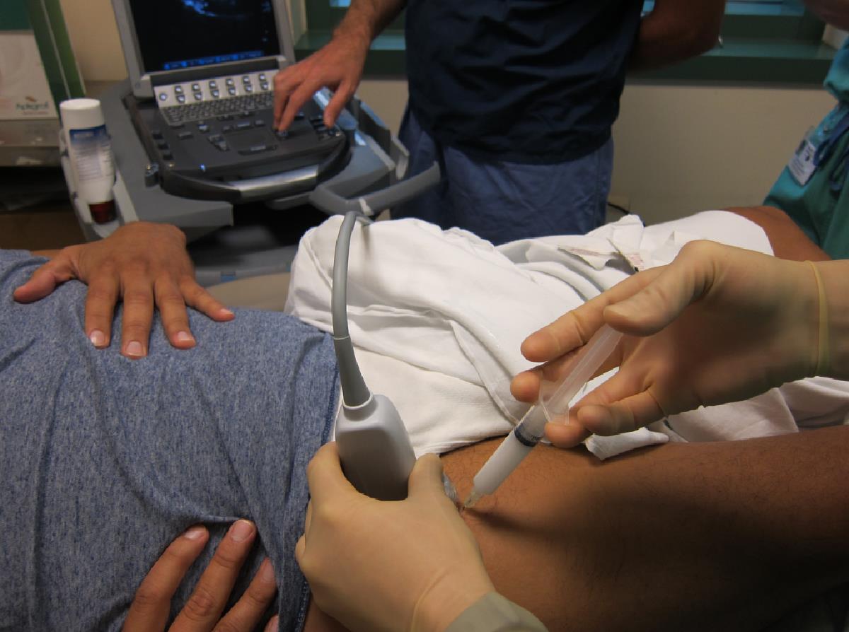 Pilot Study of Ultrasound-Guided Corticosteroid Hip Injections by Emergency Physicians